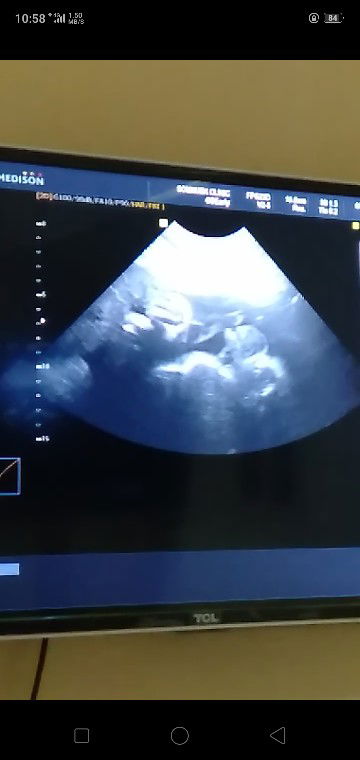 คัยคลอดสิงหาบ้างคะ