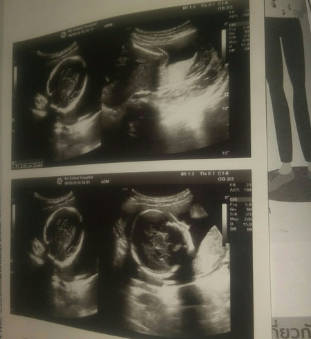 ช้วยดูหน่อยน้ะจ้า