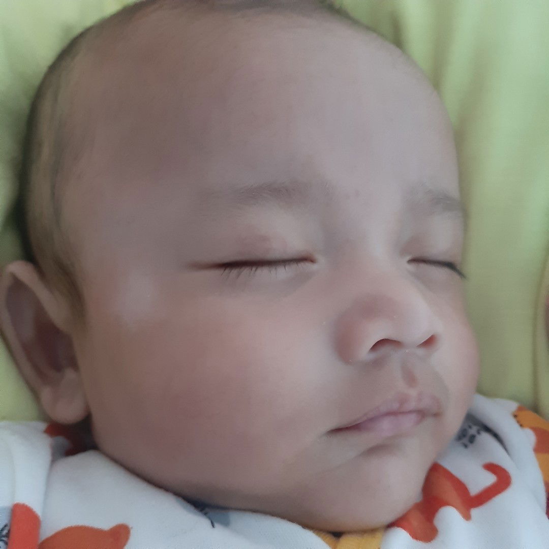kulit bayi