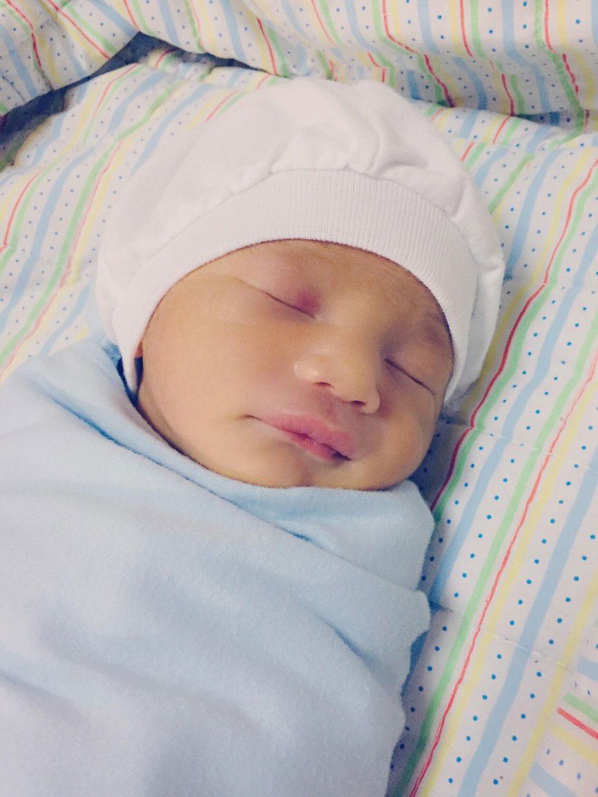 Placenta Previa Totalis