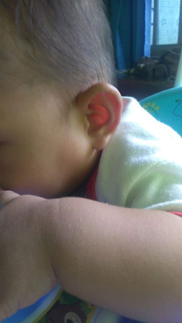 bengkak ada sedikit benjolan