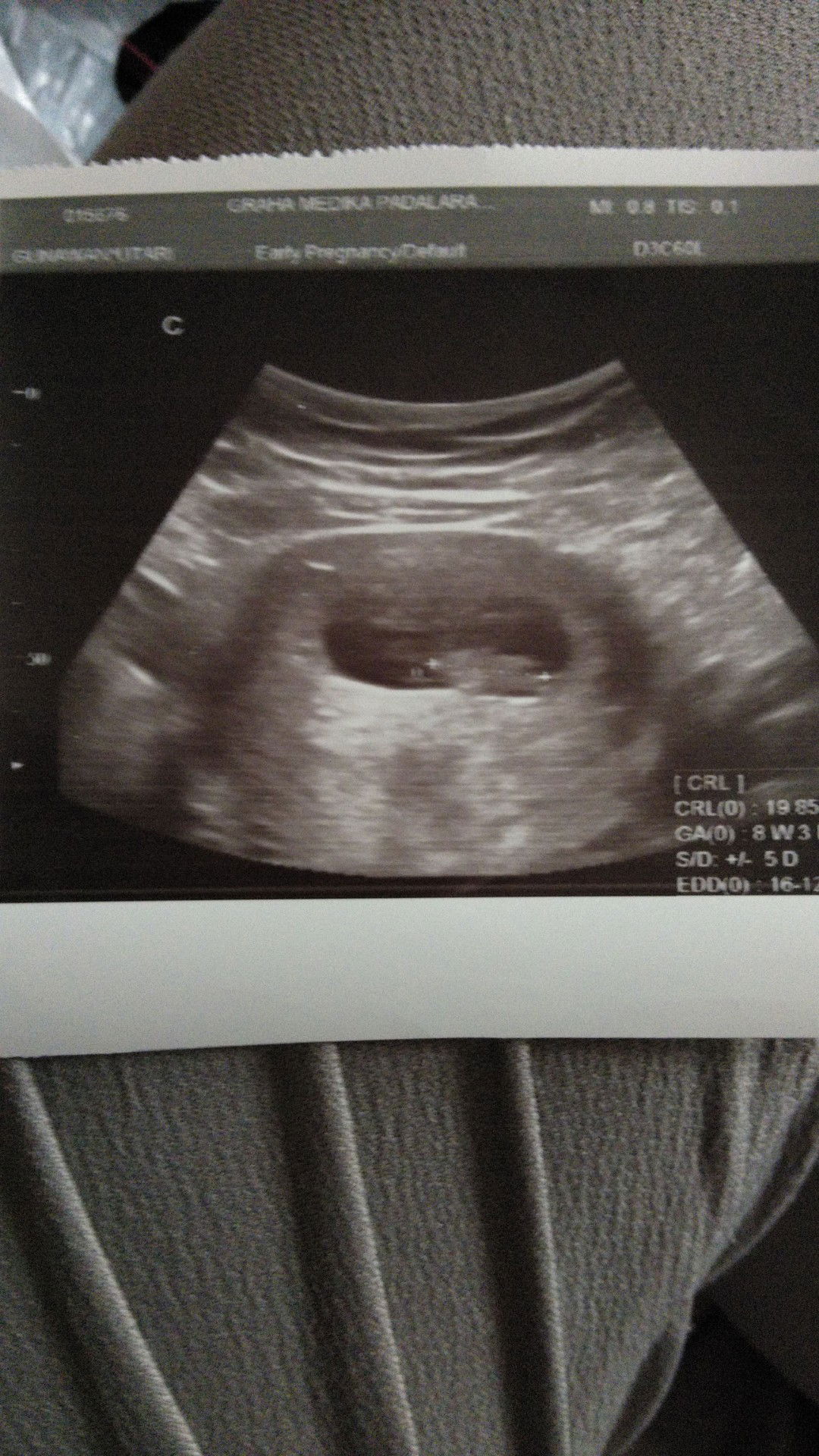 uisa usg dan hpht beda