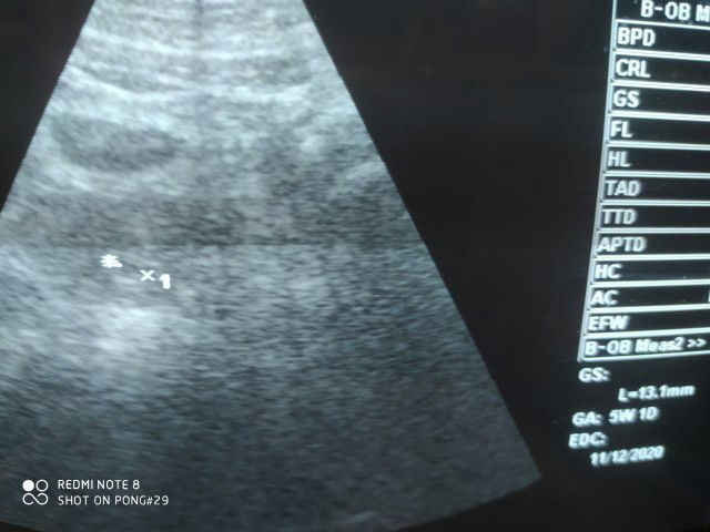 hamil BO/tidak berkembang