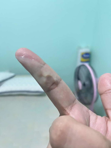 40+2  อีกนานไหมค่ะ