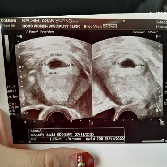 Klinik Swasta Atau Kerajaan?