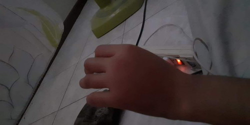 ปรึกษาตะขาบกัด