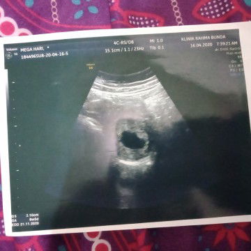 kehamilan