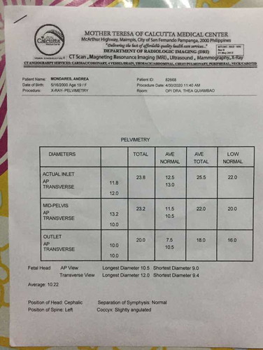 Xray pelvimetry