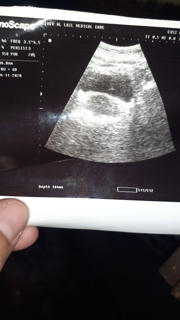 knpa hamil 8 minggu punya saya blm kelihatan janin.iy