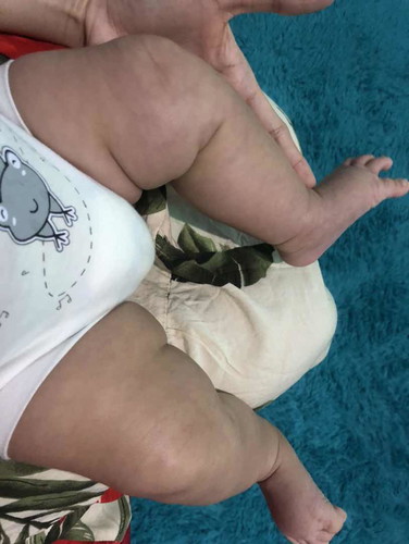 Kesehatan bayi