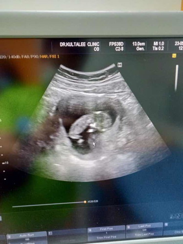11w1d