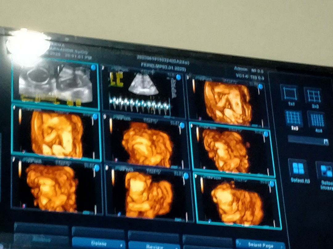 semoga sesuai predikisi🙏