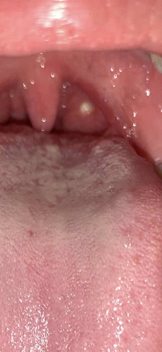 6 months preggy and natinik