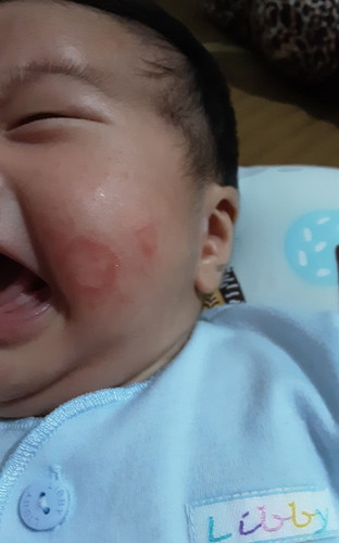 pipi merah