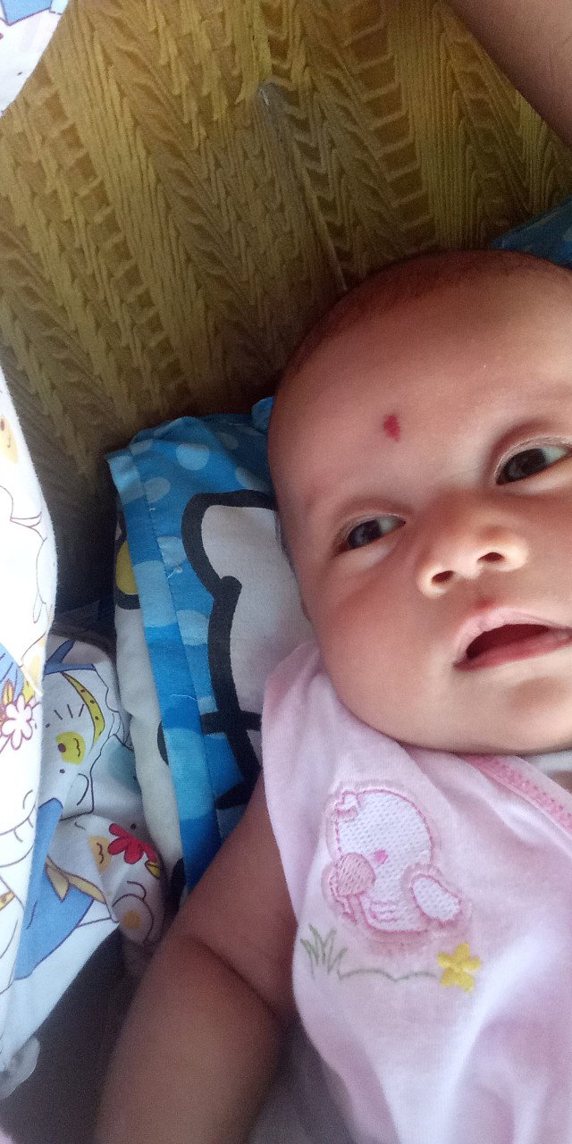 Hemangioma