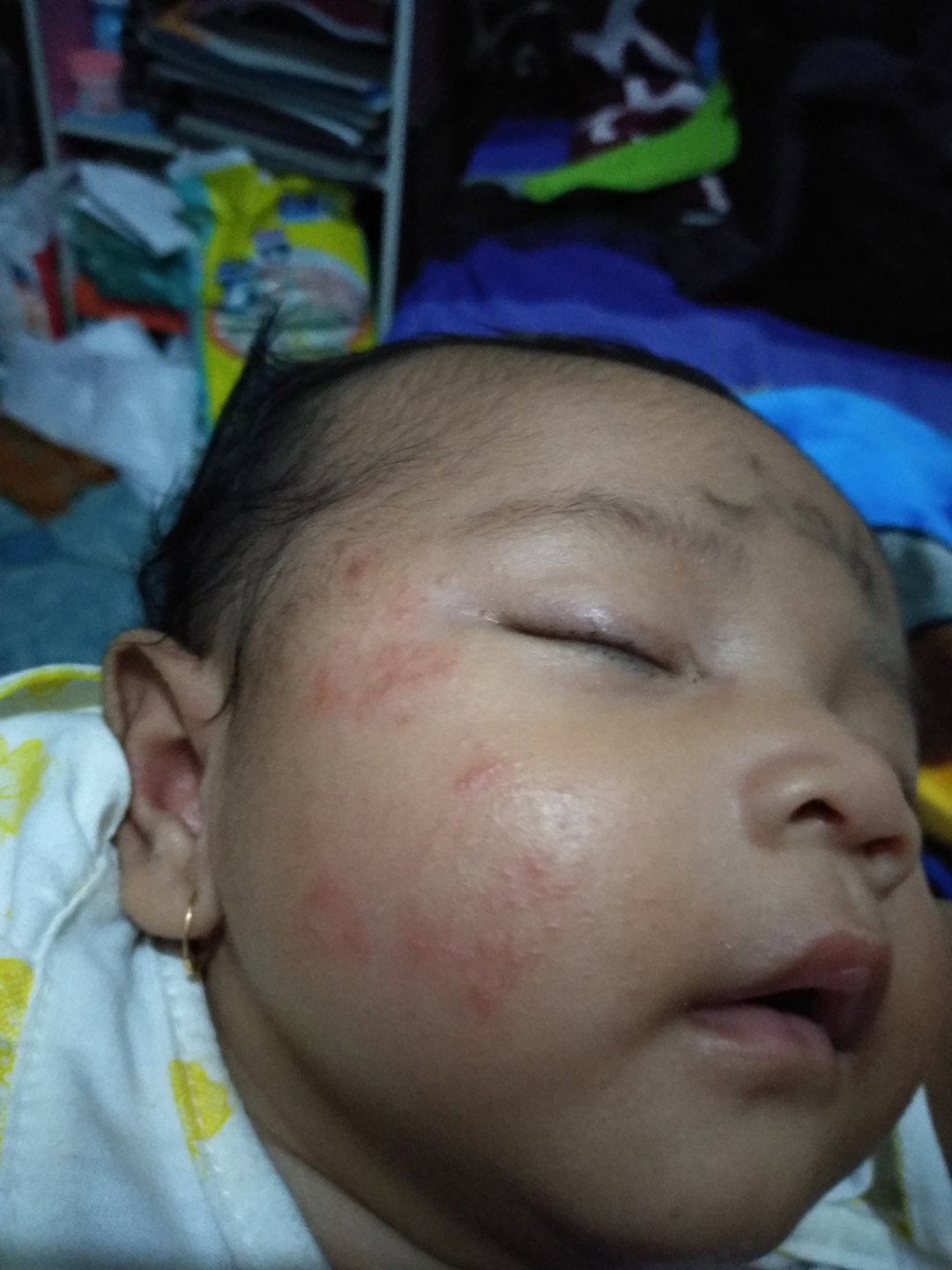 gatal