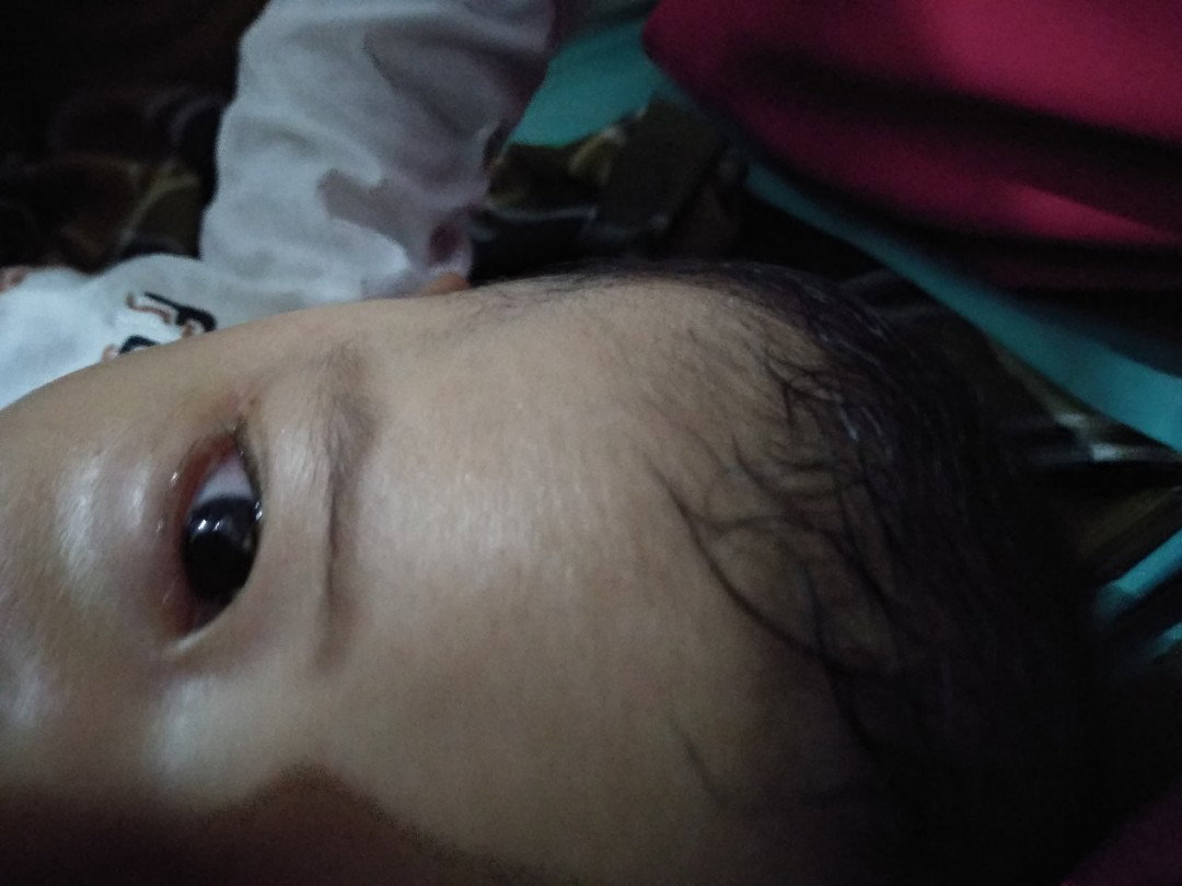 sakit mata