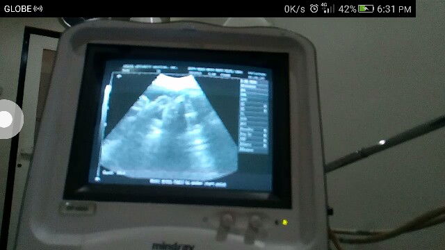 Congenital Anomaly Scan