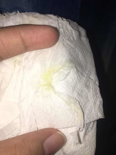 Hi mga sis tanong lang