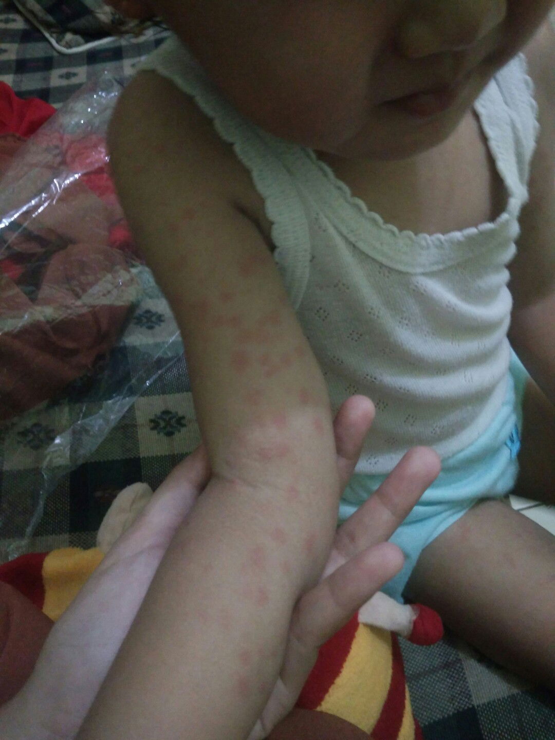 bintik merah d badan