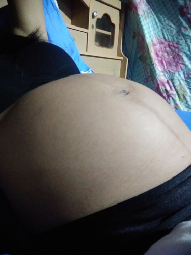 26w+1