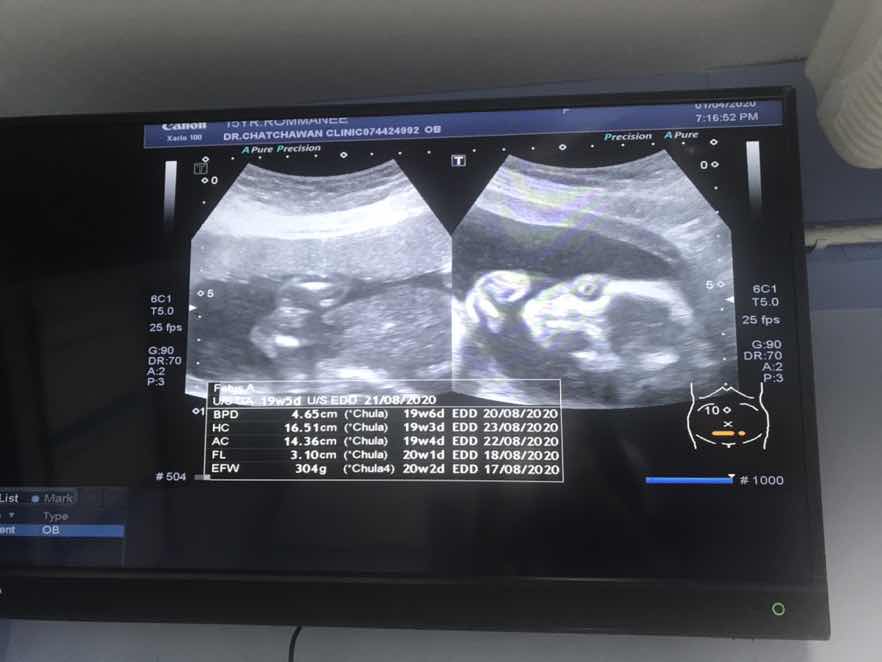 ❤️ ขอดูใบซาวแม่ๆทีมสิงหาหน่อยคะ