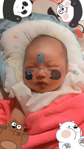 ทารก อายุ28วัน ไม่ถ่าย ถ่ายแข็ง ท้องผูก