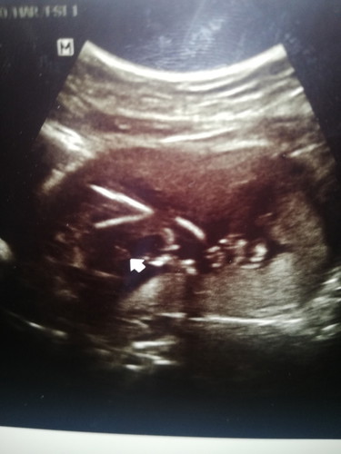 ประสบการณ์ซาวน์ครั้งแรก :)