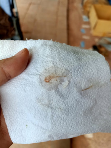 ท้องอ่อนๆมีเลือดออก