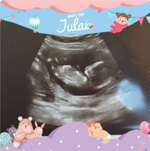 dila afila profile icon