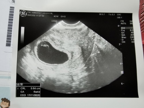 แม่ๆคนไหนเจอแบบนี้บ้างคะ