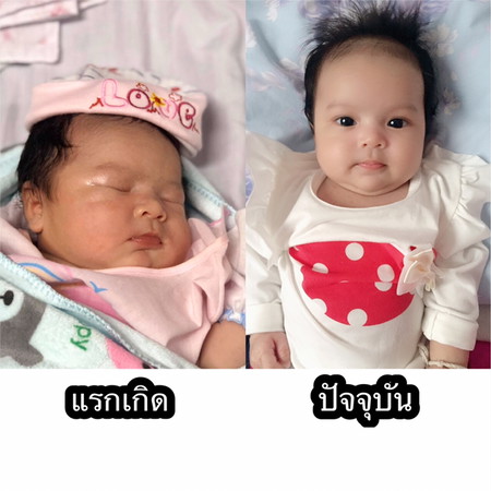 ความแตกต่าง?