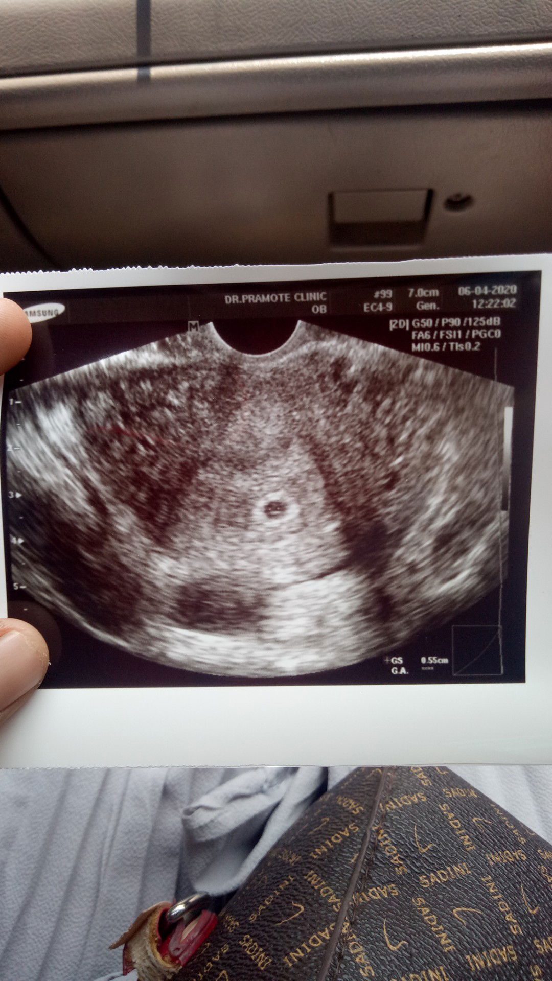 หมอยังไม่ให้ฝากครรภ์