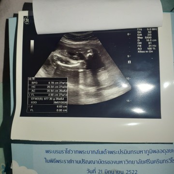 แบบนี้ผญ.รึผช.คะ