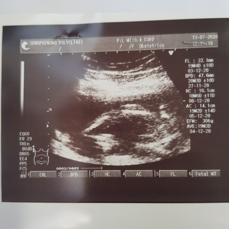 ยังไม่ชัดเจน