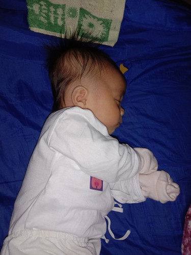 Mahaba ang ulo ni baby