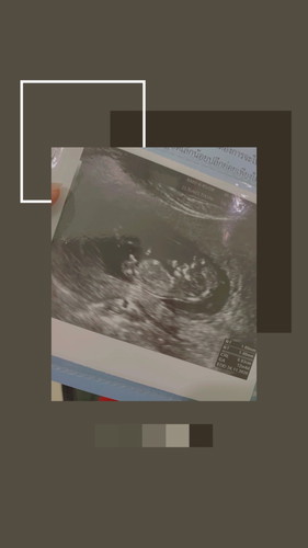 12week
