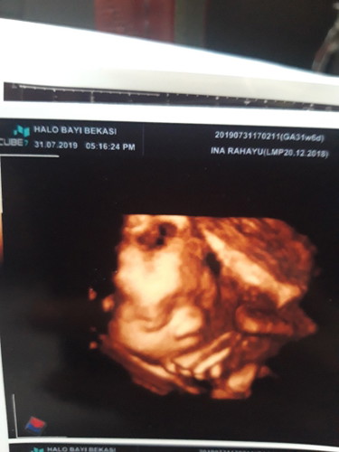 31w6day