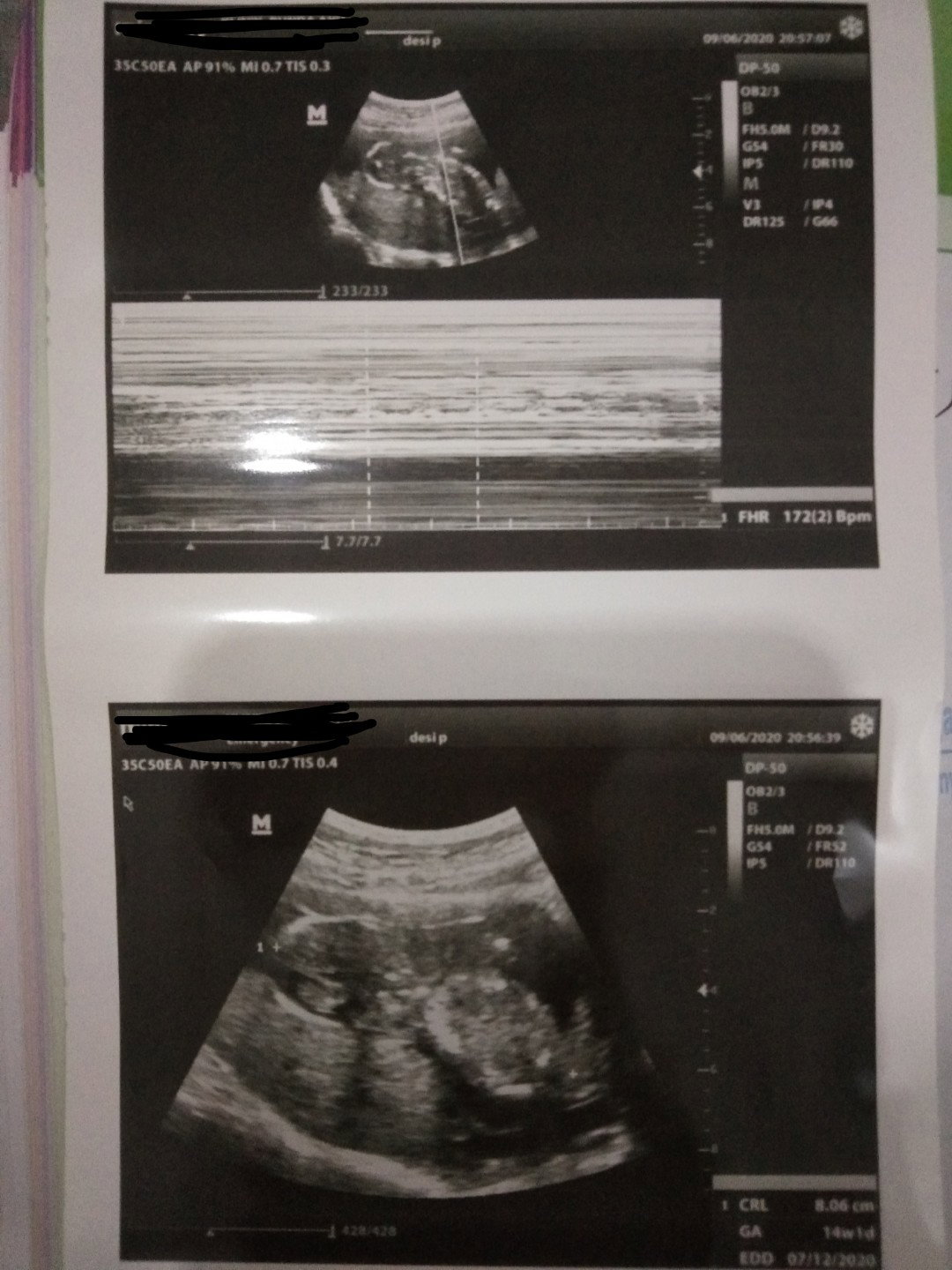 ada yang sma