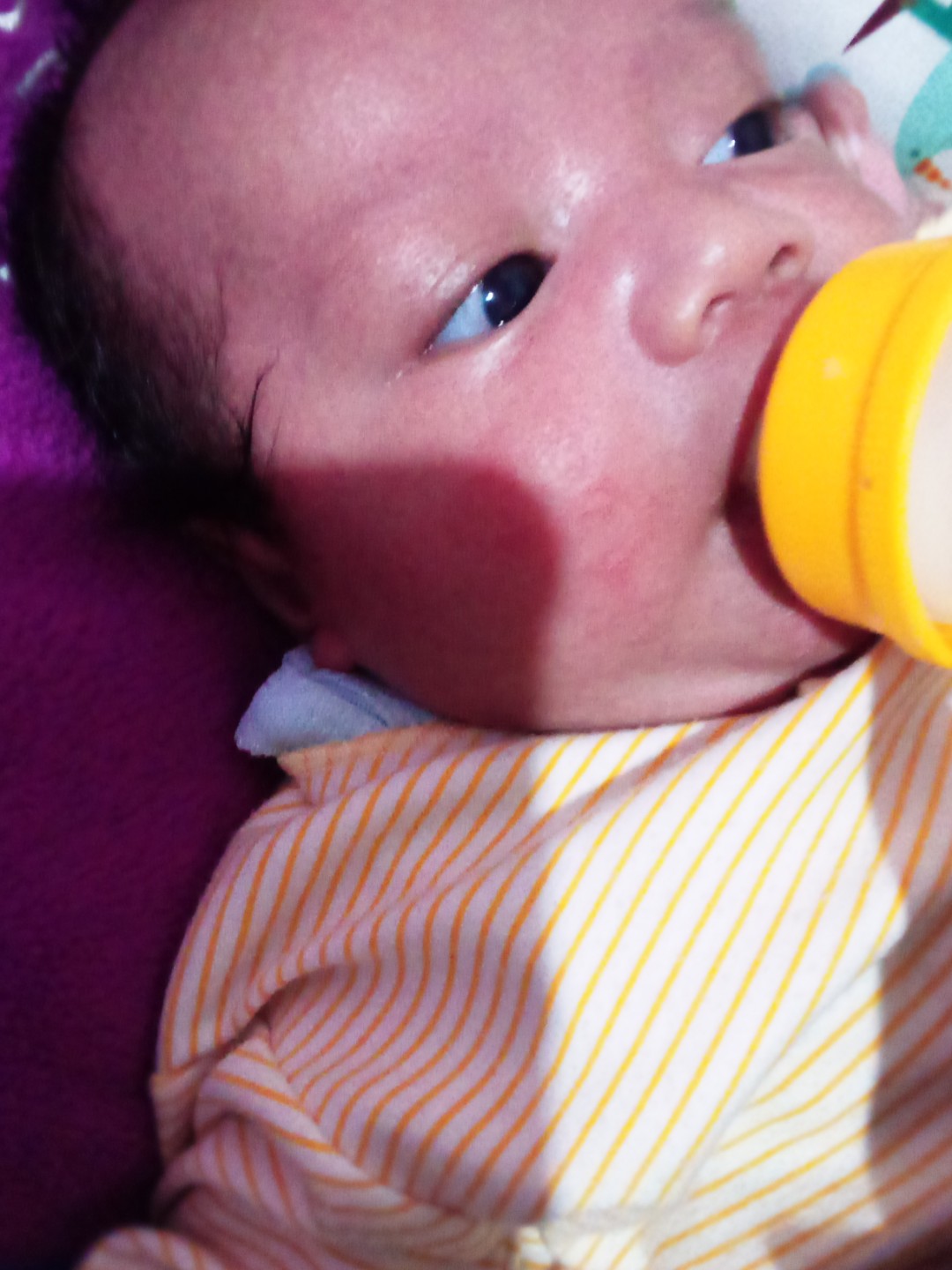 bintik merah bekas asi