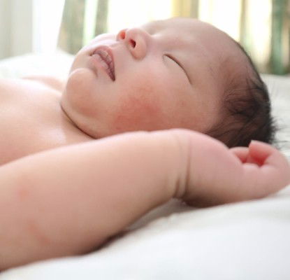 Ibu dengan anak alergi susu sapi