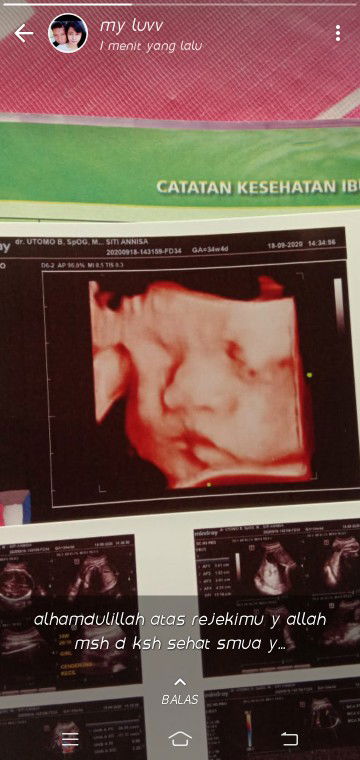 Niisaa Niisaa profile icon