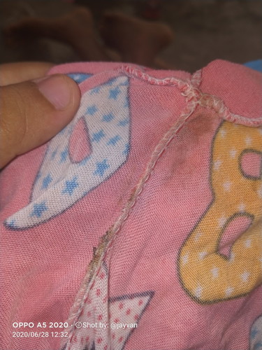 Ano po kaya ito