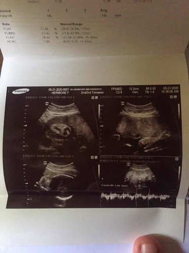 Ultrasound
