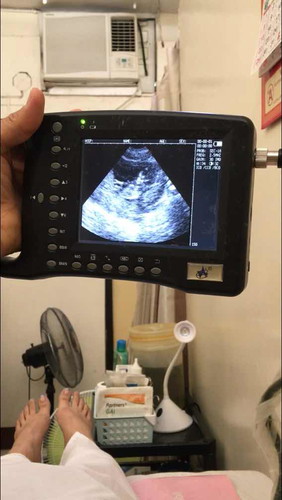 Ultrasound
