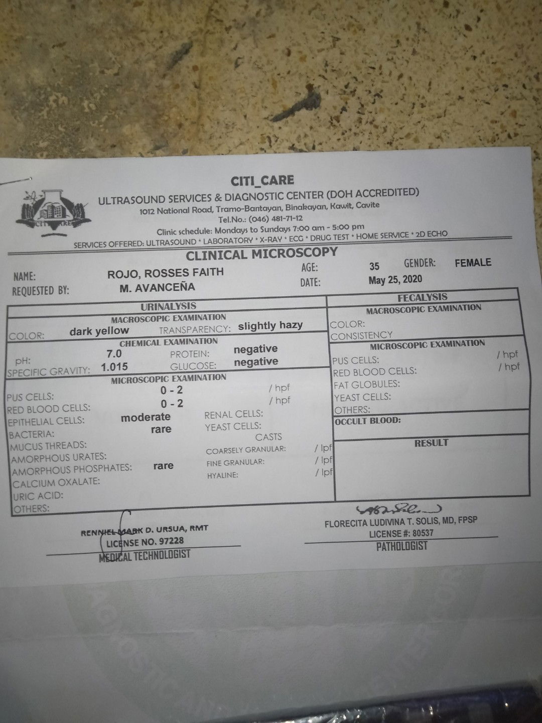 Nag aalala po ako sa urinalysis result