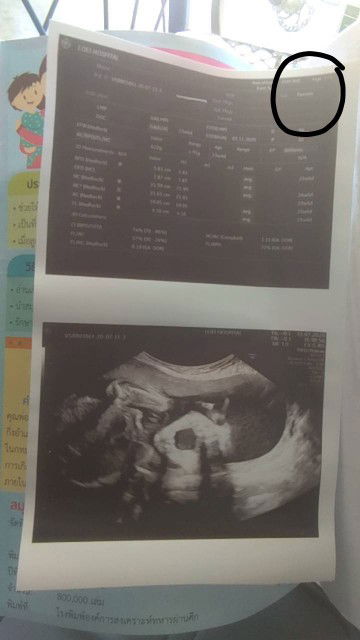 สงสัยว่าผู้หญิงหรือชายดูยังไง