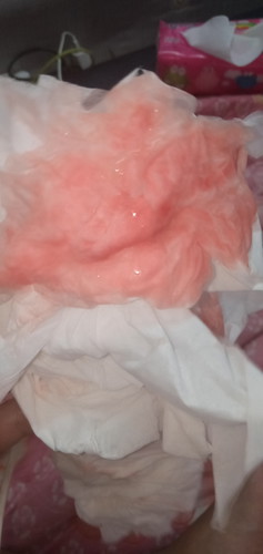 เลือดไหลแบบนี้เป็นอะไรมั้ยค่ะ ก่อนหน้านี้เคยมีนิดเดียวฉีกฝดยาฮอร์โมนแล้ว เผลอมีเพศสัมพันธ์แฟนแล้วมีน้ำไหลออกมาพร้อมเลือดใช่เลือดล้างหน้าเด็กมั้ยค่ะ จะอันตรายหรือเปล่า เด็กก็ดิ้นปกตินะค้ะ