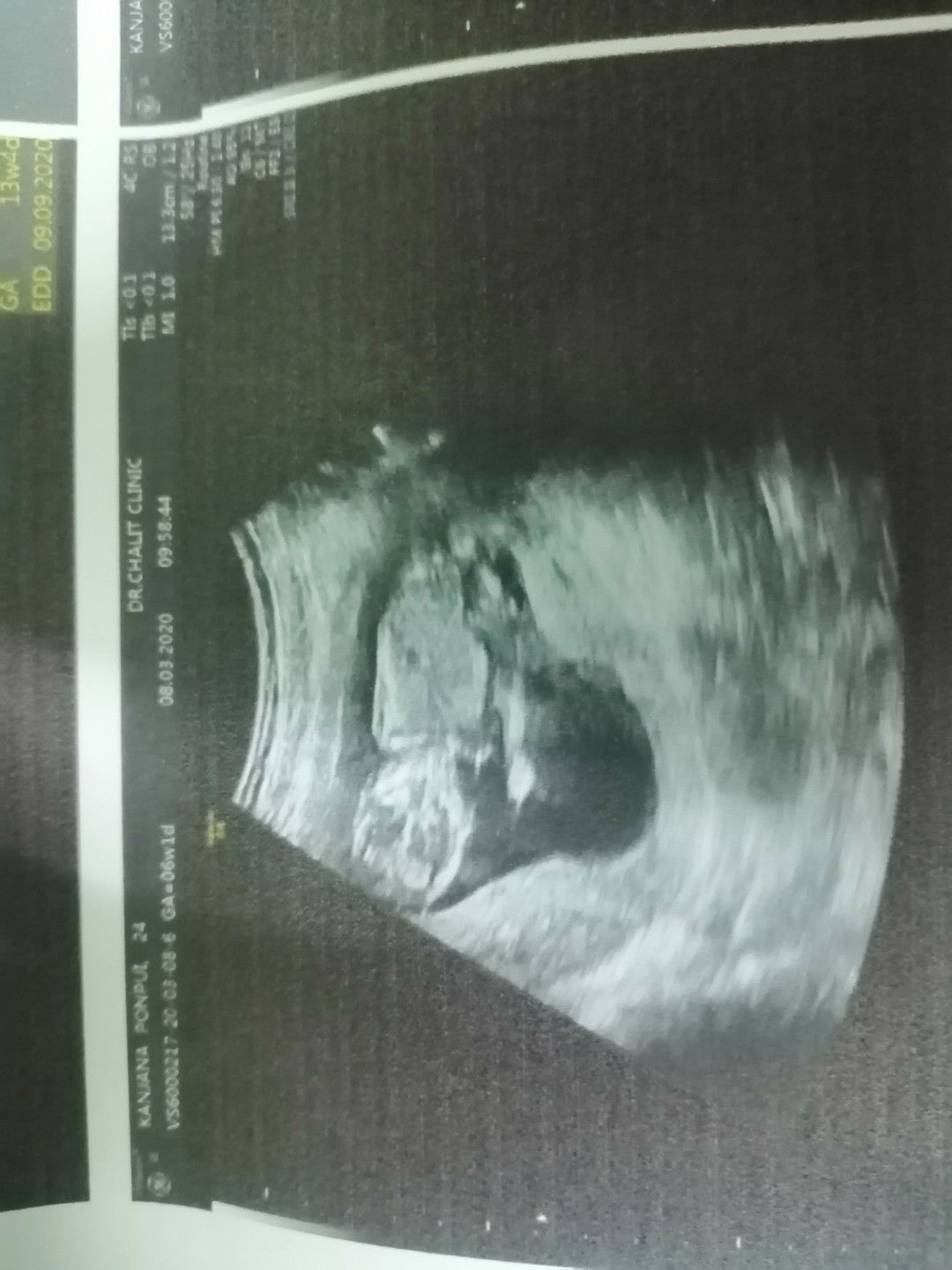 Yongyot Ain-on profile icon