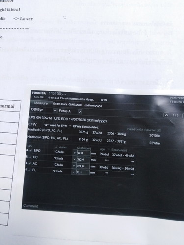 ดูตรงไหน